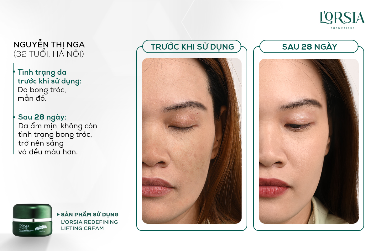 Hiệu quả sử dụng Kem dưỡng phục hồi L'Orsia Redefining Lifting Cream sau 28 ngày