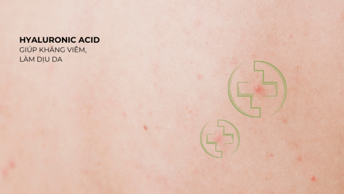 serum-hyaluronic-acid-4 Hyaluronic Acid giúp kháng viêm và làm dịu da